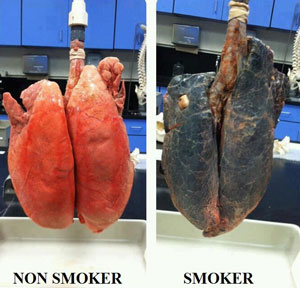 smoker-lung